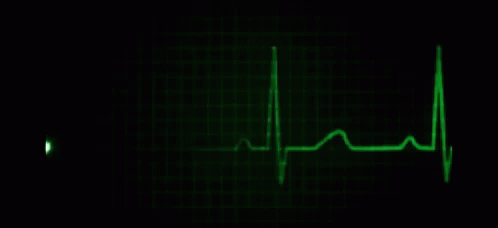 Click image for larger version

Name:	flat-line-heartbeat.gif
Views:	502
Size:	406.7 KB
ID:	4183247