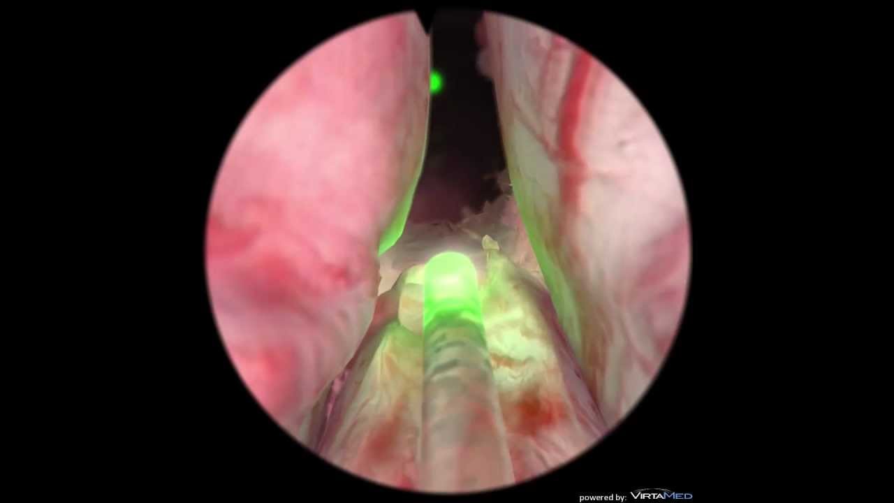 Click image for larger version

Name:	maxresdefault.jpg
Views:	281
Size:	43.6 KB
ID:	4231599