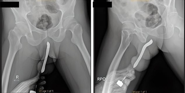 Click image for larger version

Name:	81863447-13140083-image-a-1_1709200609337.jpg
Views:	100
Size:	28.1 KB
ID:	4285704